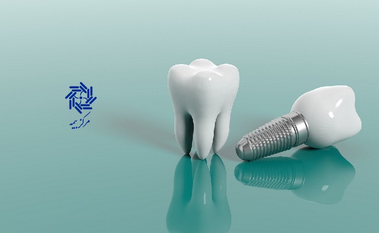 ایمپلنت با بیمه تکمیلی